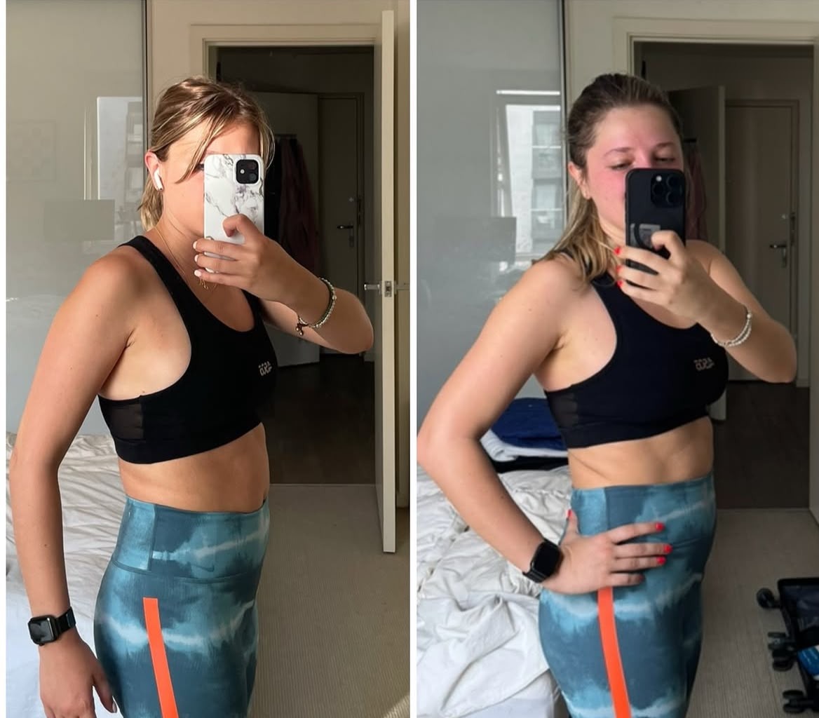 Marti side profile before and after — 8 months