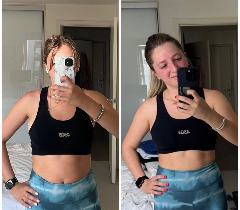 Marti before and after — 8 months