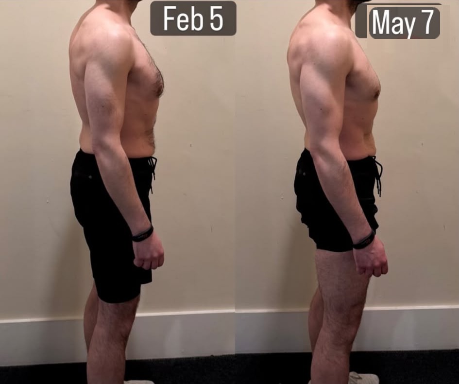 Dimi side before and after — 5 Feb to 7 May (3 months)
